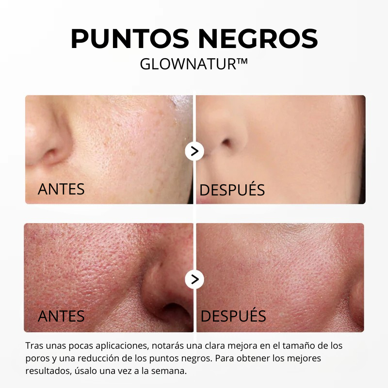 GLOWNATUR™ | Sérum Exfoliante de Arroz Iluminador