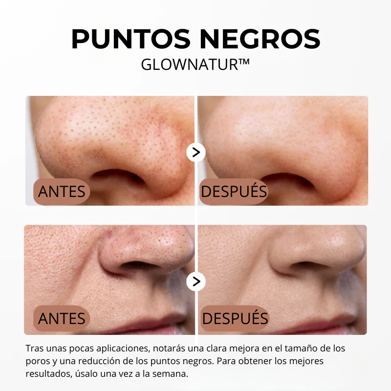 GLOWNATUR™ | Sérum Exfoliante de Arroz Iluminador